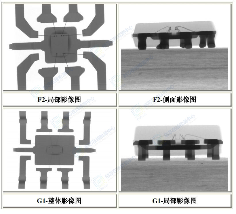 X-ray jiancha2.jpg